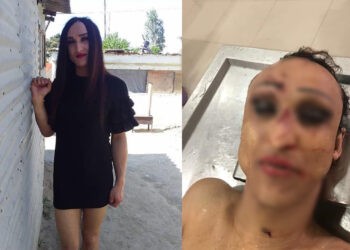 Bakıda transgender qadın bıçaqlanaraq qətlə yetirilib