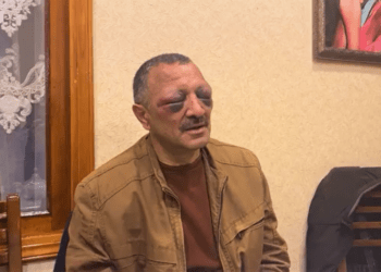 Amnesty International reacts to beating of Tofig Yagublu